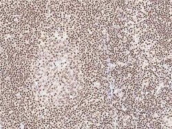 TR4/NR2C2 Antibody, Novus Biologicals 100 &mu;g, Unconjugated:Anticuerpos