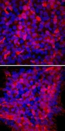 TRA-1-60(R) Antibody (TRA-1-60) - Azide and BSA Free, Novus Biologicals