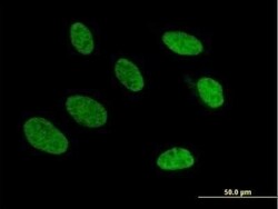 TRA2A Antibody, Novus Biologicals 0.05 mg | Buy Online | Novus Biologicals | Fisher Scientific