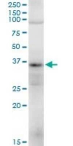 TRA2A Antibody, Novus Biologicals 0.05 mg | Buy Online | Novus Biologicals | Fisher Scientific