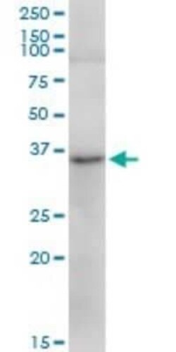 TRA2A Antibody, Novus Biologicals 0.05 mg | Buy Online | Novus Biologicals | Fisher Scientific