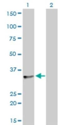 TRA2B Antibody (7A1), Novus Biologicals 0.1 mg | Buy Online | Novus Biologicals | Fisher Scientific