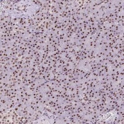 TRA2B Antibody, Novus Biologicals 25 &mu;L, Unconjugated:Antibodies, Polyclonal