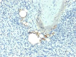 TRACP/PAP/ACP5 Antibody (ACP5/1070), Novus Biologicals:Antibodies:Primary
