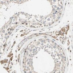 TRAF-2 Antibody, Novus Biologicals 25 &mu;L | Buy Online | Novus Biologicals | Fisher Scientific