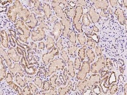 TRAF3IP1 Antibody, Novus Biologicals:Antibodies:Primary Antibodies