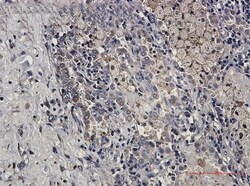 TRAILR4/TNFRSF10D/DcR2 Antibody (S01-1F0), Novus Biologicals 50 &mu;g | Buy Online | Novus Biologicals | Fisher Scientific