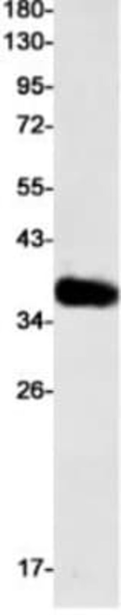 TRAILR4/TNFRSF10D/DcR2 Antibody (S01-1F0), Novus Biologicals 50 &mu;g | Buy Online | Novus Biologicals | Fisher Scientific