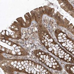 TRAIP Antibody, Novus Biologicals 25 &mu;L, Unconjugated:Antibodies, Polyclonal