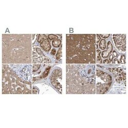 TRAIP Antibody, Novus Biologicals 25 &mu;L, Unconjugated:Antibodies, Polyclonal
