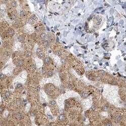 TRAIP Antibody, Novus Biologicals 25 &mu;L, Unconjugated:Antibodies, Polyclonal