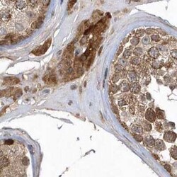 TRAIP Antibody, Novus Biologicals 25 &mu;L, Unconjugated:Antibodies, Polyclonal