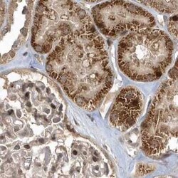 TRAIP Antibody, Novus Biologicals 25 &mu;L, Unconjugated:Antibodies, Polyclonal