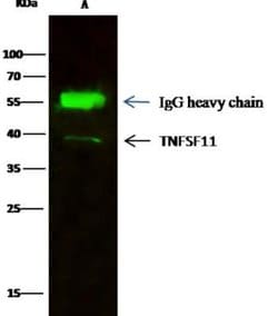 TRANCE/TNFSF11/RANK L Rabbit anti-Human, Clone: 101, Novus Biologicals