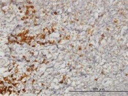 TRAP alpha Antibody (1A12), Novus Biologicals 0.1 mg | Buy Online | Novus Biologicals | Fisher Scientific