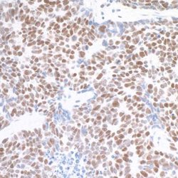 TRAP220/MED1 Antibody (BLR037F), Novus Biologicals 100 &mu;L; Unconjugated:Antibodies,