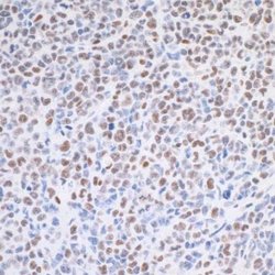 TRAP220/MED1 Antibody (BLR037F), Novus Biologicals 100 &mu;L; Unconjugated:Antibodies,
