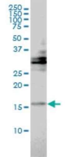 Novus Biologicals TRAPPC2 Antibody (2E10), Novus Biologicals 0.1 mg | Buy Online | Novus Biologicals&trade; | Fisher Scientific