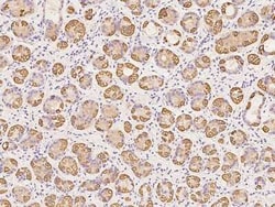 TRAPPC2L Antibody, Novus Biologicals 100 &mu;g, Unconjugated:Antibodies,