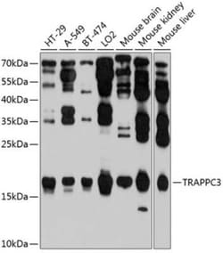 TRAPPC3 Antibody - BSA Free, Novus Biologicals:Antibodies:Primary Antibodies