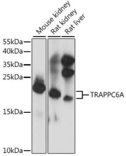 TRAPPC6A Antibody - Azide and BSA Free, Novus Biologicals 0.1 mL; Unconjugated:Antibodies,
