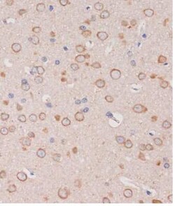 TRAPPC6B Antibody - Azide and BSA Free, Novus Biologicals 0.1 mL, Unconjugated:Antibodies,