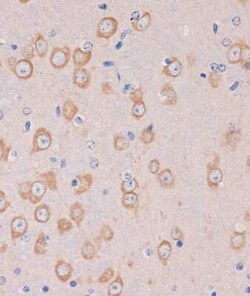 TRAPPC6B Antibody - Azide and BSA Free, Novus Biologicals 0.1 mL, Unconjugated:Antibodies,