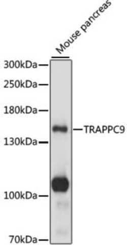 TRAPPC9 Antibody - Azide and BSA Free, Novus Biologicals 0.1 mL, Unconjugated:Antibodies,