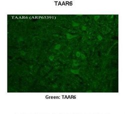 TRAR4 Antibody, Novus Biologicals 100 &mu;L; Unconjugated:Antibodies, Polyclonal
