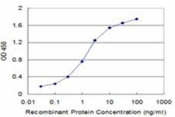 Novus Biologicals TRBP Antibody (1D9), Novus Biologicals 0.1 mg | Buy Online | Novus Biologicals&trade; | Fisher Scientific