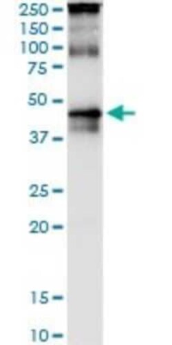 Novus Biologicals TRBP Antibody (1D9), Novus Biologicals 0.1 mg | Buy Online | Novus Biologicals&trade; | Fisher Scientific