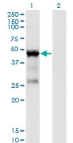 Novus Biologicals TRBP Antibody (1D9), Novus Biologicals 0.1 mg | Buy Online | Novus Biologicals&trade; | Fisher Scientific