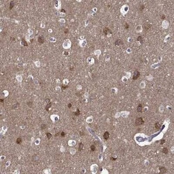 TRBP Antibody, Novus Biologicals 25 &mu;L, Unconjugated:Antibodies, Polyclonal