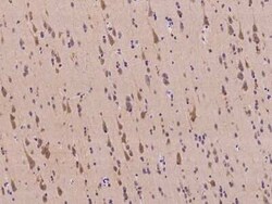 TRBP Antibody, Novus Biologicals:Antibodies:Primary Antibodies