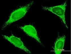 TRDD3 Antibody, Novus Biologicals 0.05 mg | Buy Online | Novus Biologicals | Fisher Scientific