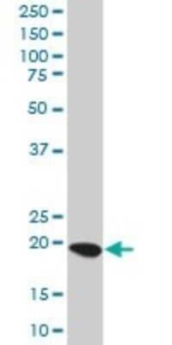 TRDD3 Antibody, Novus Biologicals 0.05 mg | Buy Online | Novus Biologicals | Fisher Scientific