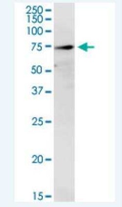 TREH Antibody (2D10), Novus Biologicals 100 &mu;g | Buy Online | Novus Biologicals | Fisher Scientific