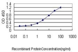 TREM1 Antibody (2E2), Novus Biologicals 0.1 mg, Unconjugated:Antibodies,