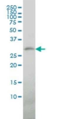 TREM1 Antibody (2E2), Novus Biologicals 0.1 mg, Unconjugated:Antibodies,