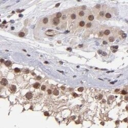 TRF-2 Antibody, Novus Biologicals:Antibodies:Primary Antibodies
