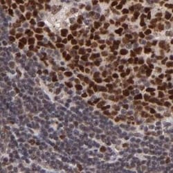 TRF-2 Antibody, Novus Biologicals:Antibodies:Primary Antibodies