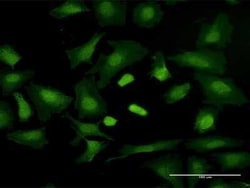 TRGV3 Antibody, Novus Biologicals 50 &mu;g | Buy Online | Novus Biologicals | Fisher Scientific
