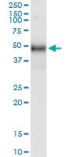 Novus Biologicals TRIB1 Antibody (4A10), Novus Biologicals 0.1 mg | Buy Online | Novus Biologicals&trade; | Fisher Scientific