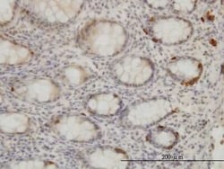 TRIB2 Antibody (1B1), Novus Biologicals 0.1 mg | Buy Online | Novus Biologicals | Fisher Scientific