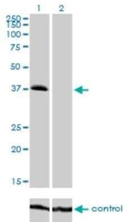 TRIB2 Antibody (1B1), Novus Biologicals 0.1 mg | Buy Online | Novus Biologicals | Fisher Scientific