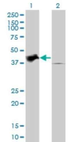 TRIB2 Antibody (1B1), Novus Biologicals 0.1 mg | Buy Online | Novus Biologicals | Fisher Scientific