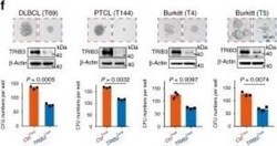 TRIB3 Antibody (1H2), Novus Biologicals 0.1 mg; Unconjugated:Antibodies,