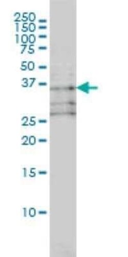 TRIB3 Antibody (1H2), Novus Biologicals 0.1 mg; Unconjugated:Antibodies,