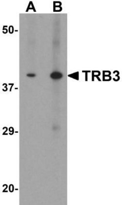 TRIB3 Antibody - BSA Free, Novus Biologicals 0.1 mg | Buy Online | Novus Biologicals | Fisher Scientific