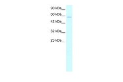 TRIM10 Rabbit anti-Human, Polyclonal, Novus Biologicals 0.1 mL; Unconjugated:Antibodies,